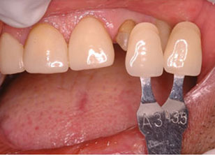 Clinical Applications of Dental Photography