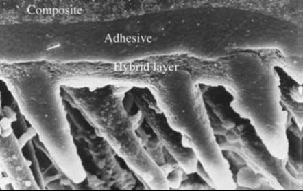 Different Bonding Technique